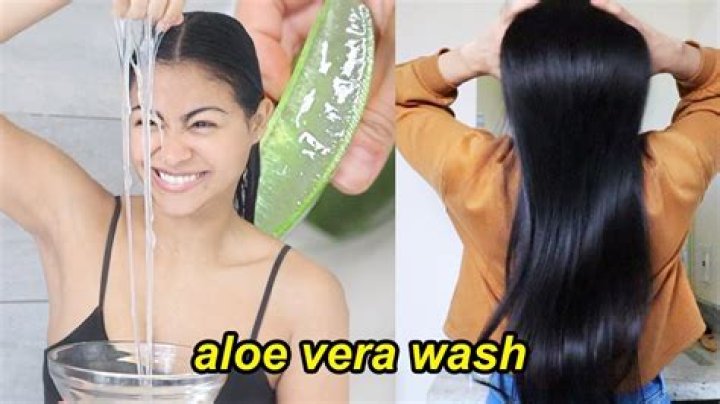 Can I use aloe vera gel on my scalp?