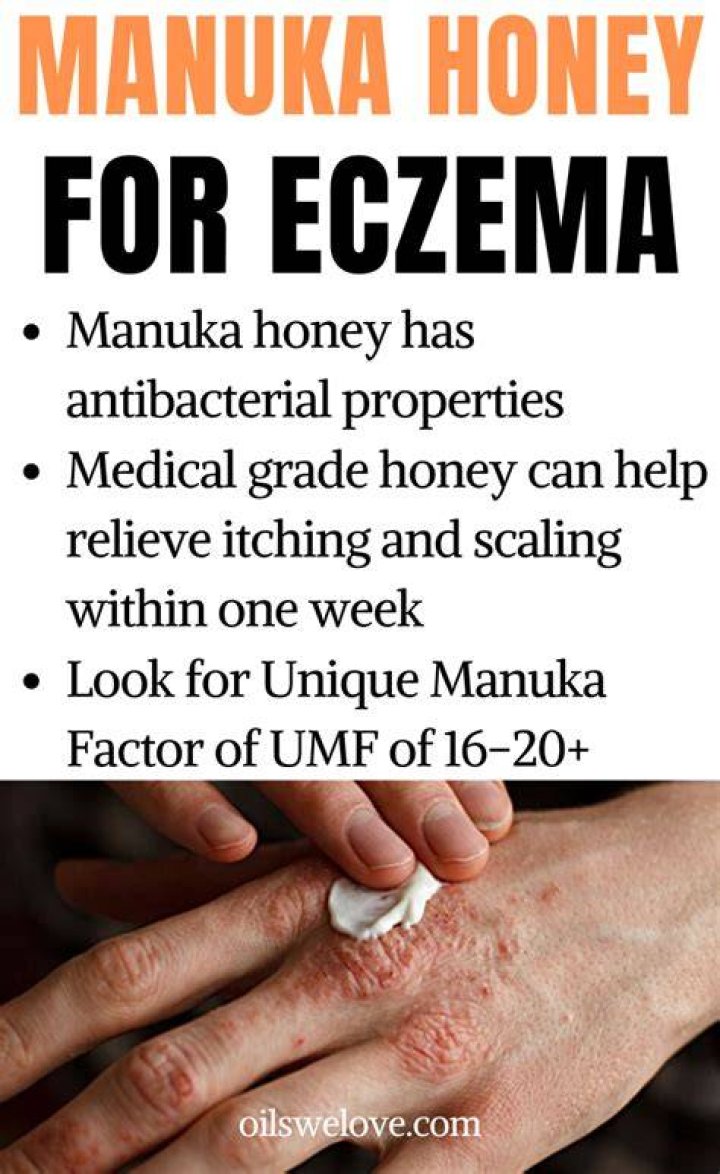 Is eating honey good for eczema?