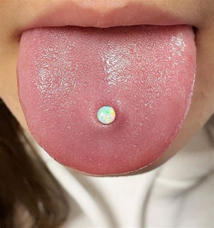What's the white stuff around my tongue piercing?