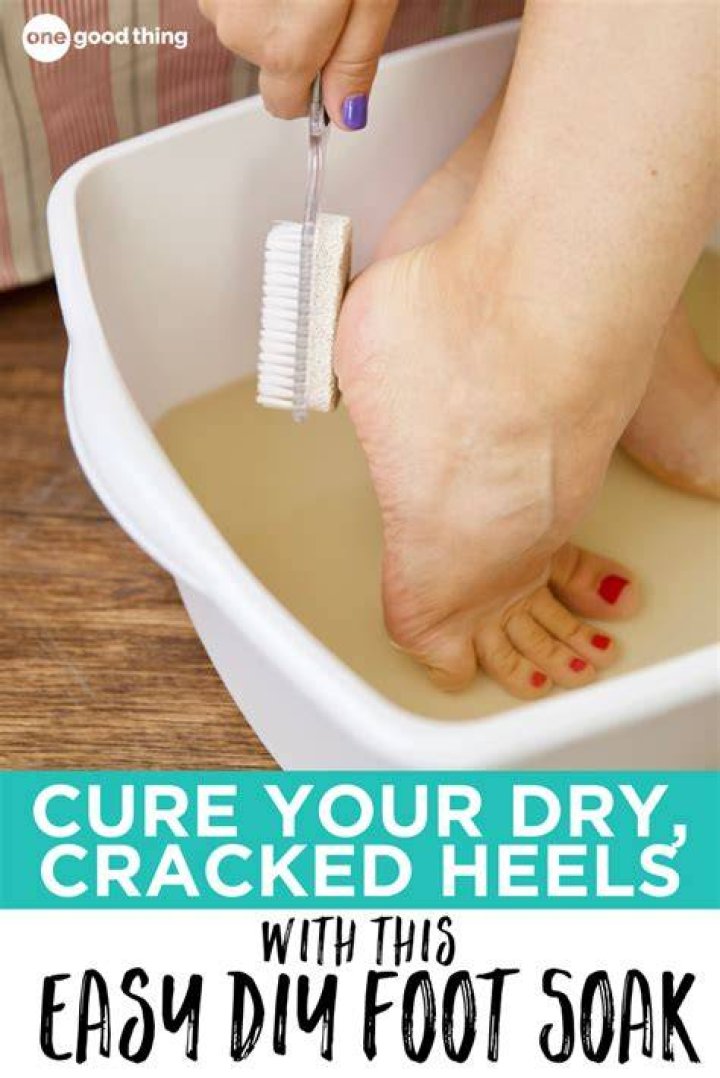 What do you soak cracked heels in?