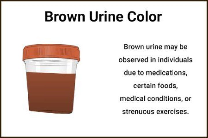 What foods cause brown urine?